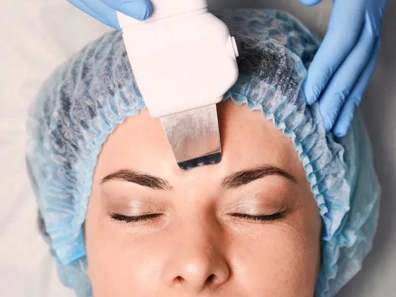 Medizinische Gesichtsbehandlung: Reinigung der Stirnhaut mit einem Gerät