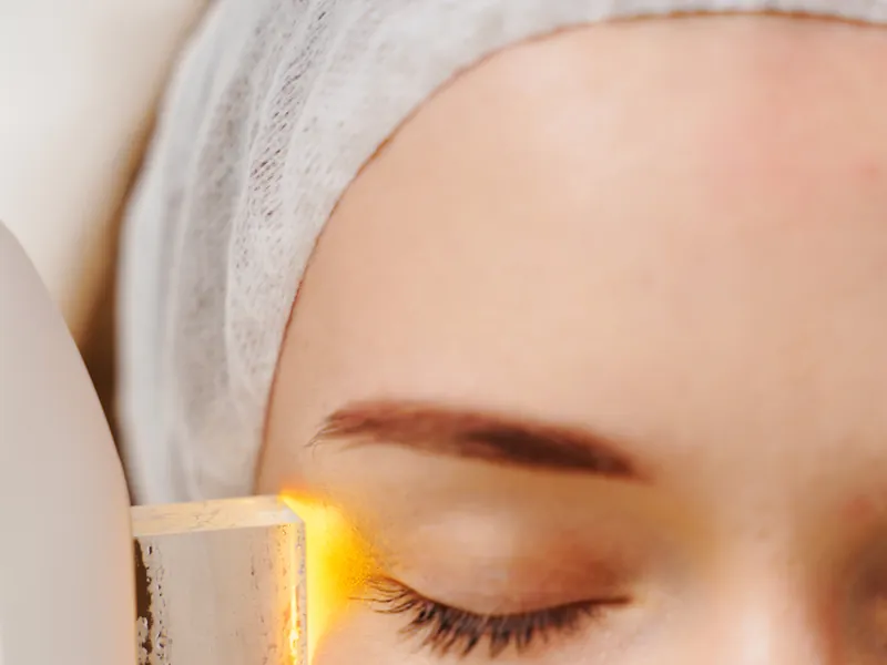 Licht- und Laserbehandlung der Gesichtshaut mit Handstück