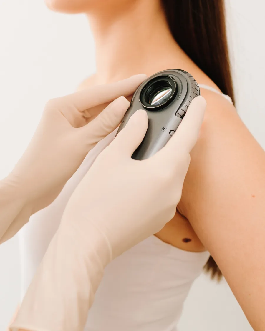 Behandschuhte Hände setzen ein Dermatoskop auf die Schulter auf, im Bild ein kleines dunkles Mal