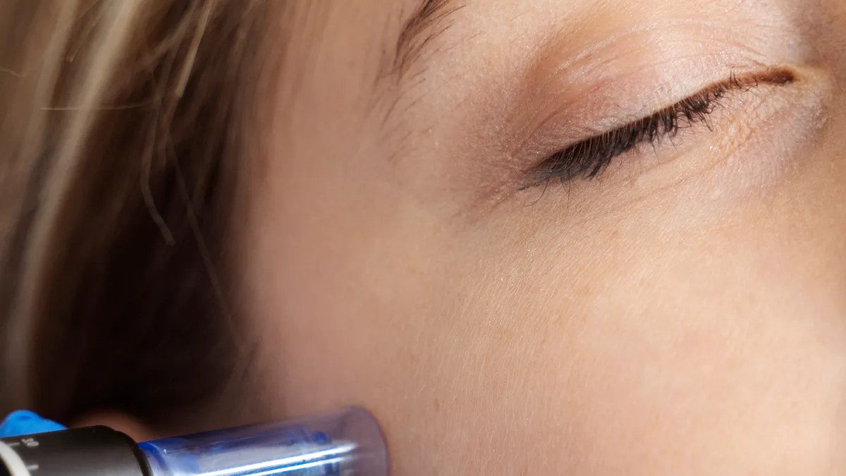 Microneedling-Pen wird über die Wange geführt