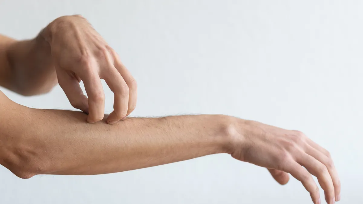 Hand kratzt die gerötete, juckende Haut am Unterarm