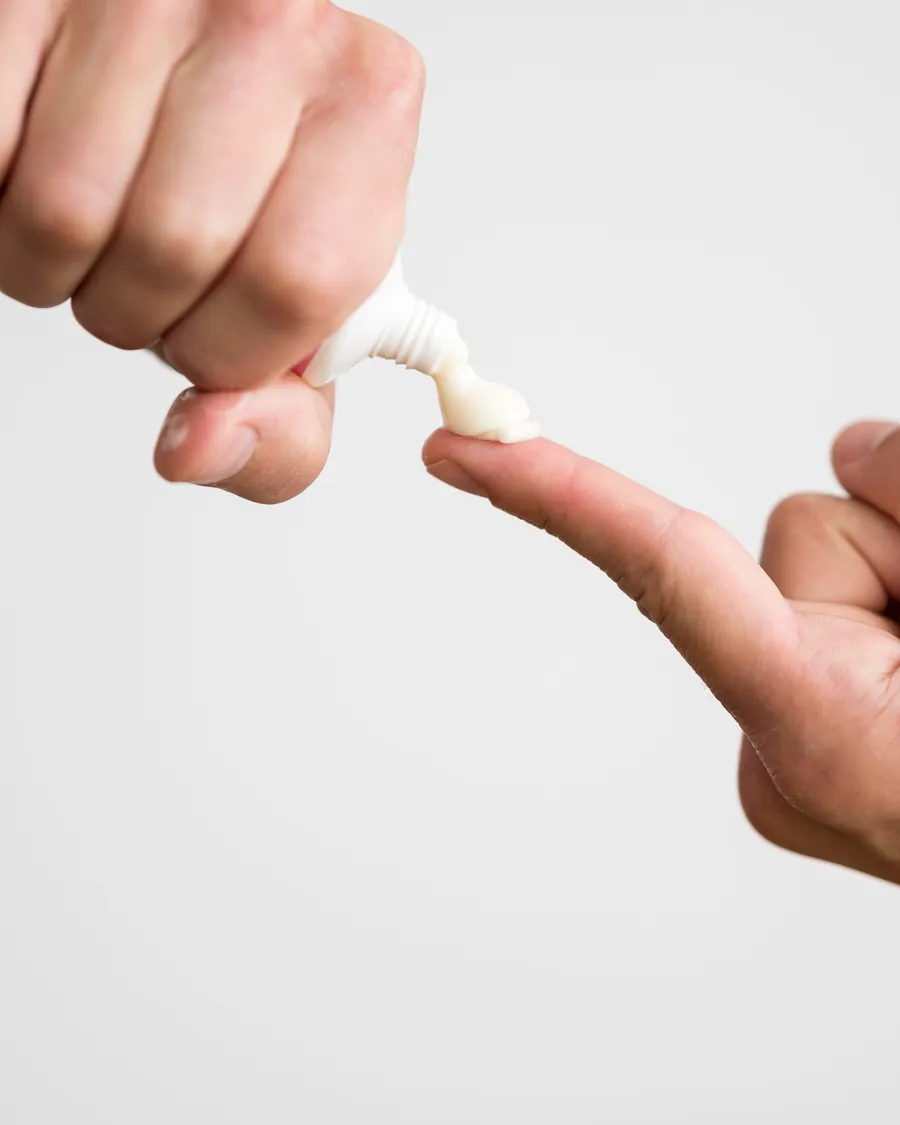 Salbe wird aus der Tube auf die Fingerspitze gegeben