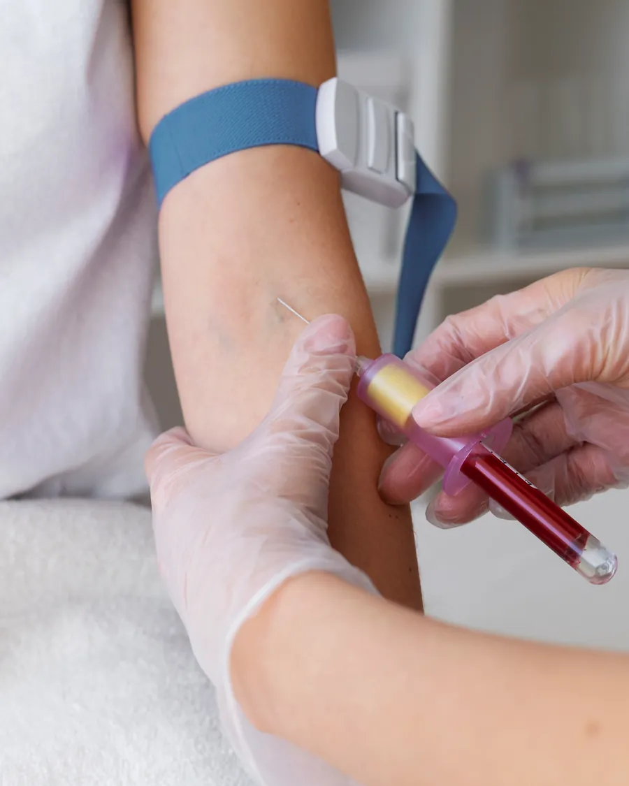Blutentnahme am Arm zu Beginn einer PRP-Behandlung